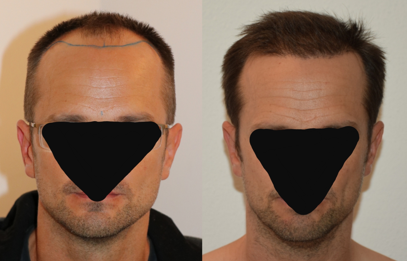 /foren/transplant/index.php/fa/46787/0/