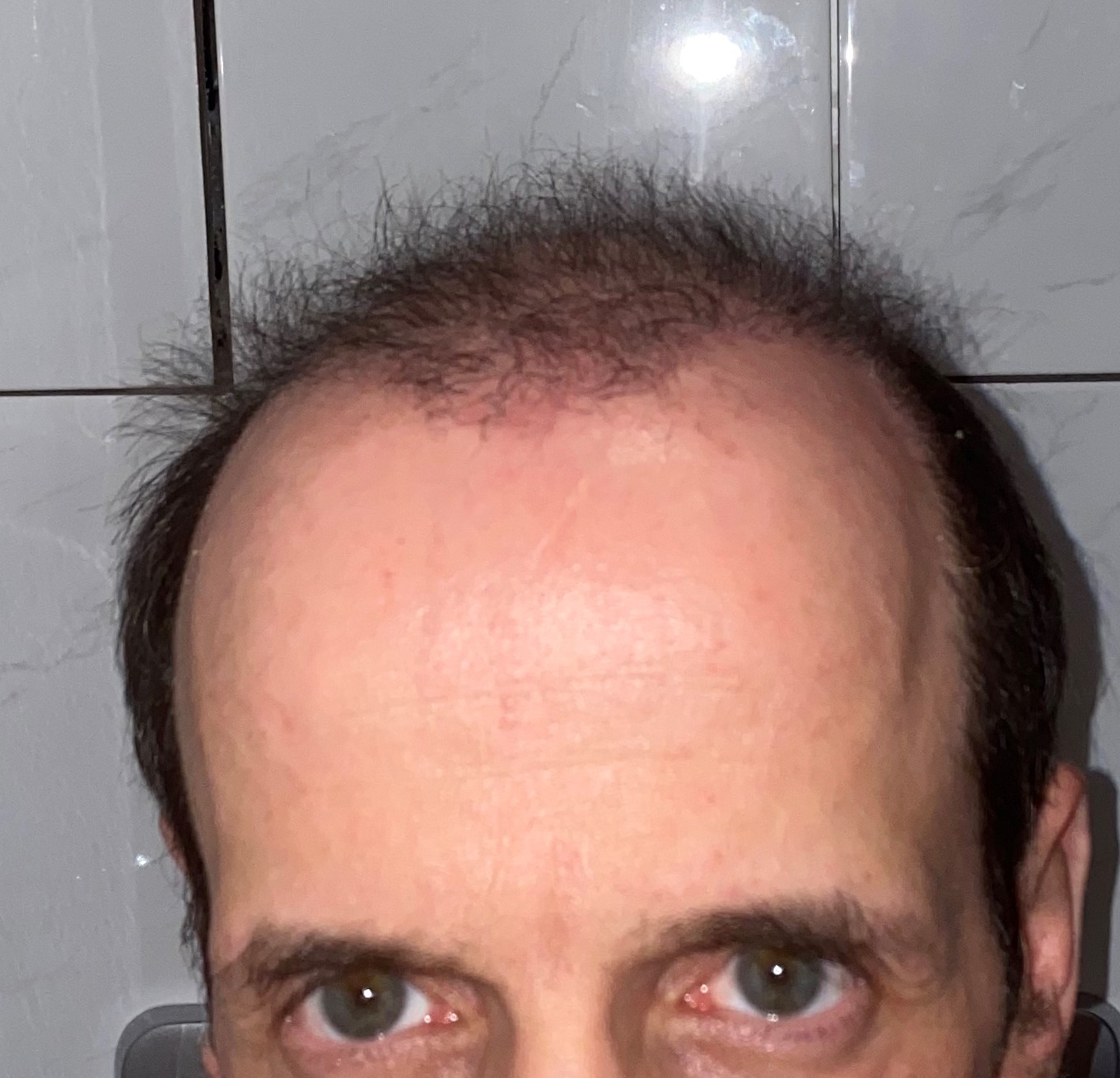 /foren/transplant/index.php/fa/46797/0/