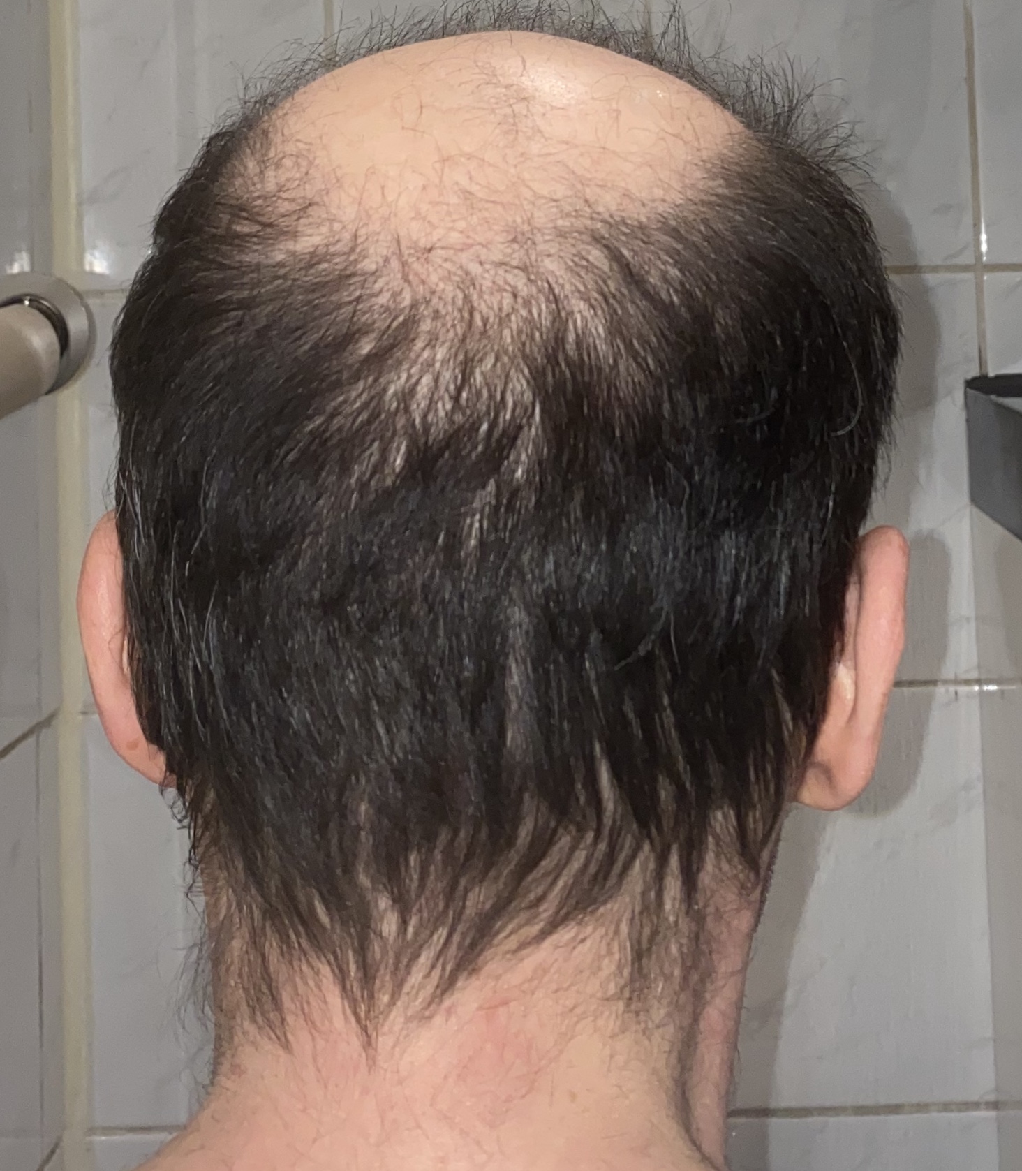 /foren/transplant/index.php/fa/46798/0/