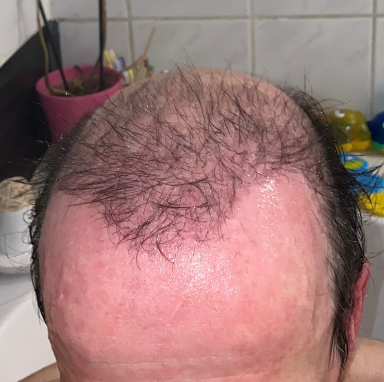 /foren/transplant/index.php/fa/46799/0/