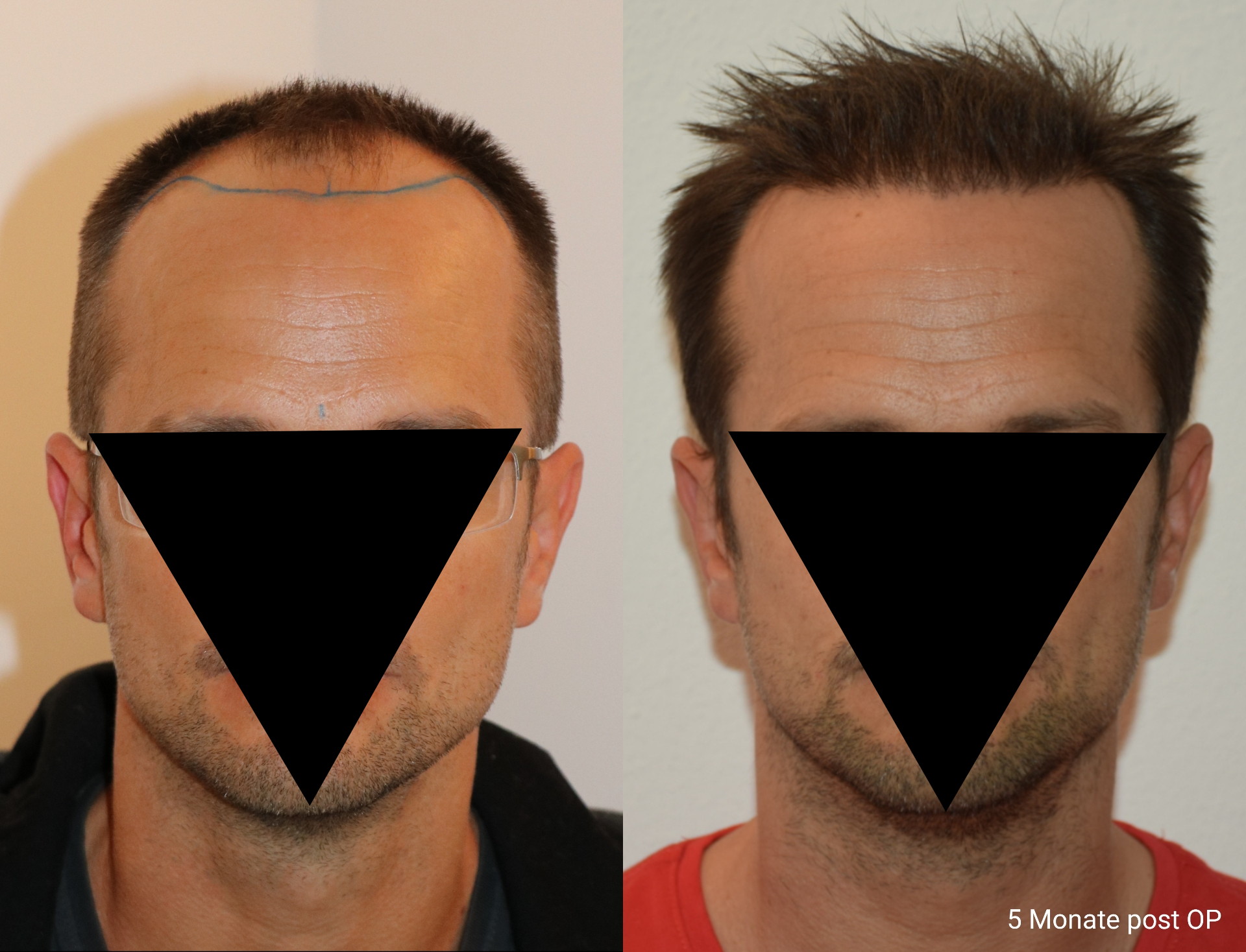 /foren/transplant/index.php/fa/46806/0/