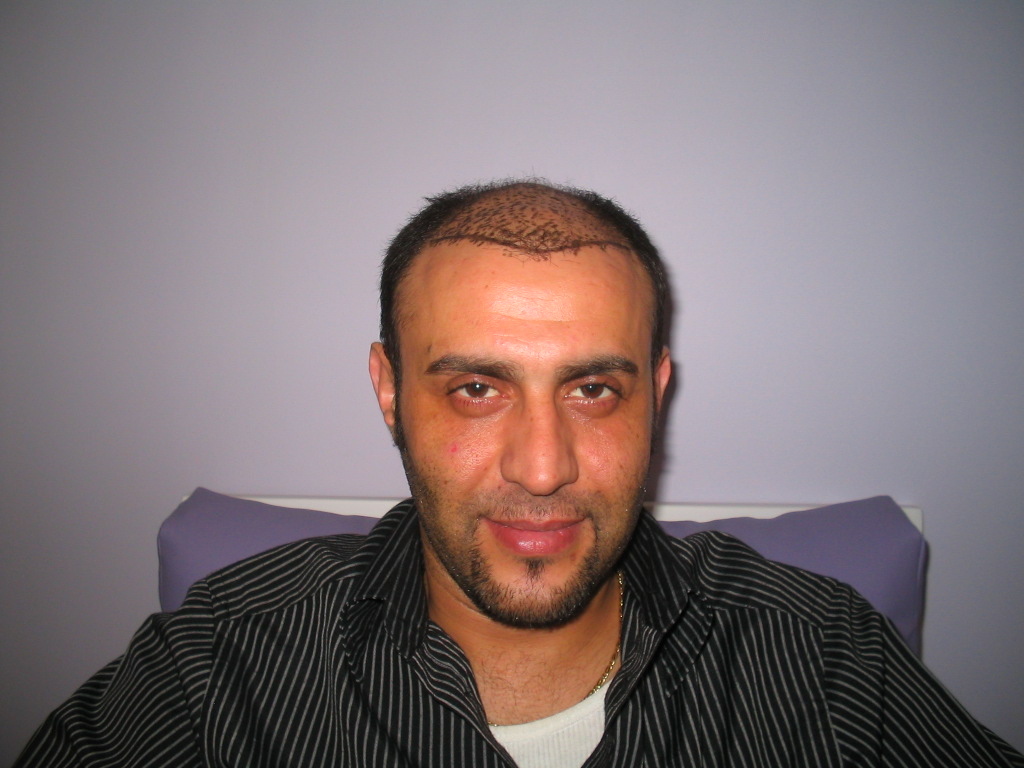 index.php/fa/4684/0/