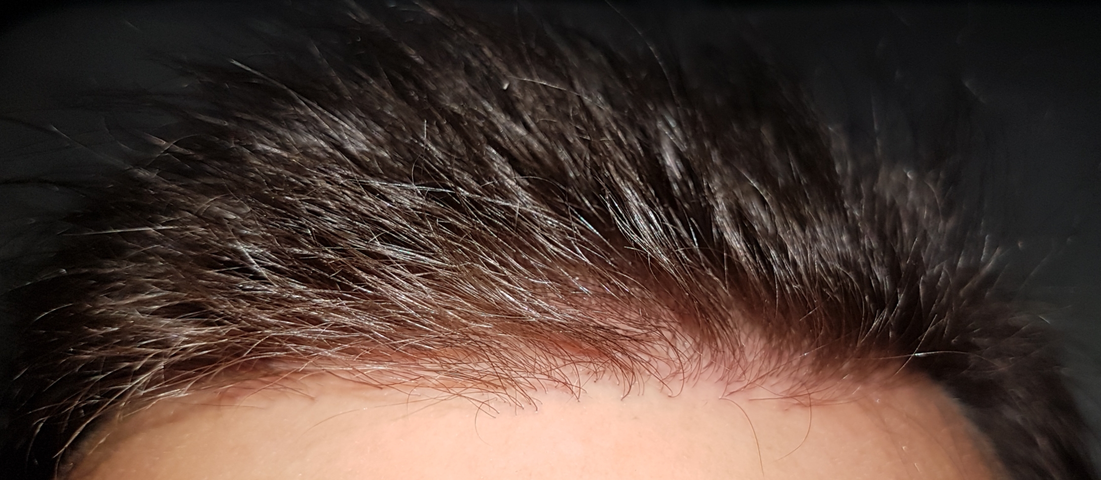 /foren/transplant/index.php/fa/46841/0/