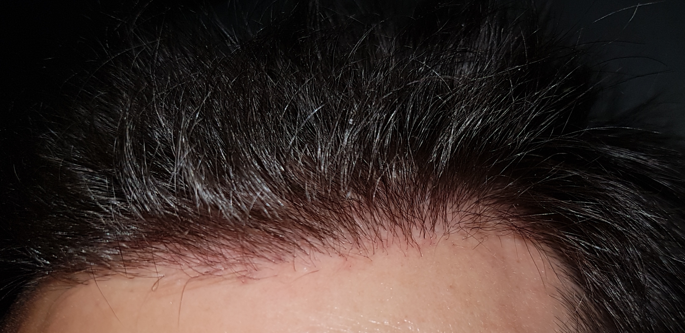 /foren/transplant/index.php/fa/46842/0/