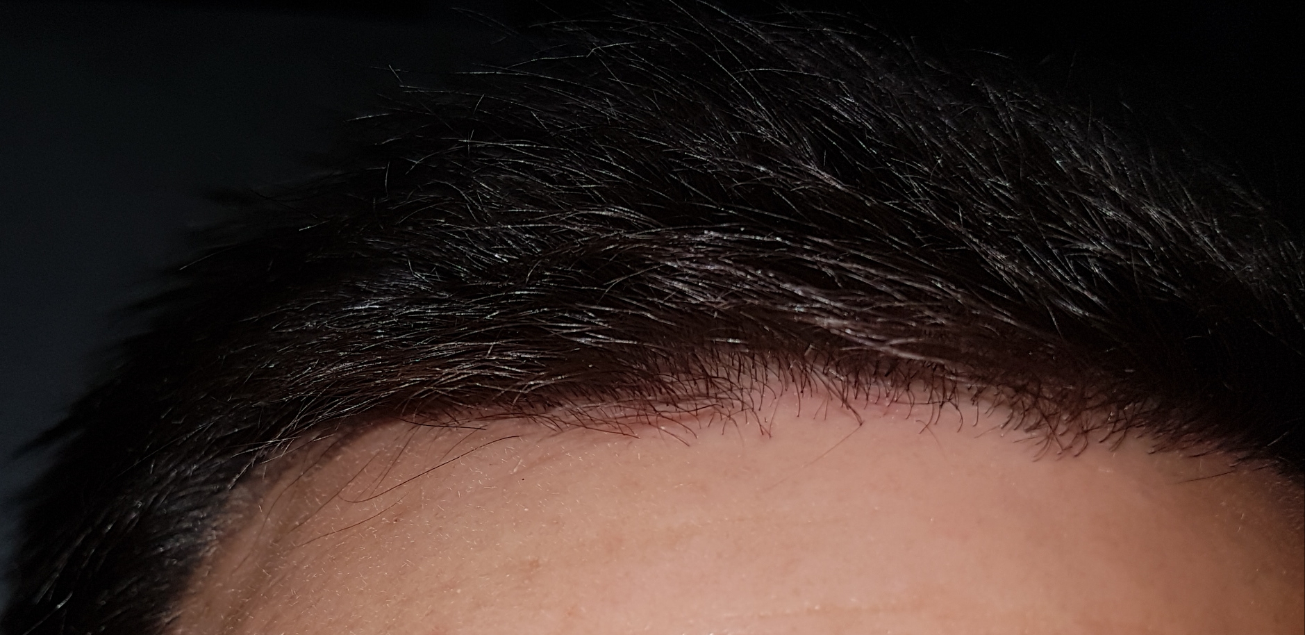 /foren/transplant/index.php/fa/46843/0/