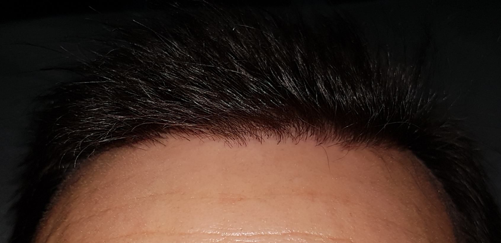 /foren/transplant/index.php/fa/46844/0/