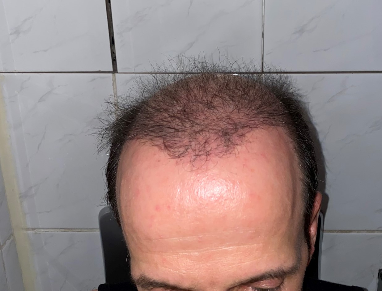 /foren/transplant/index.php/fa/46859/0/