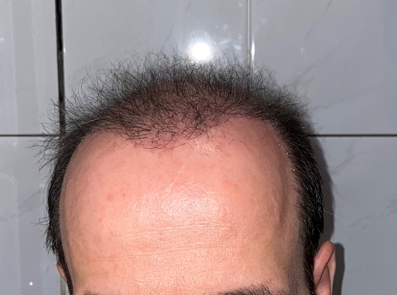 /foren/transplant/index.php/fa/46862/0/