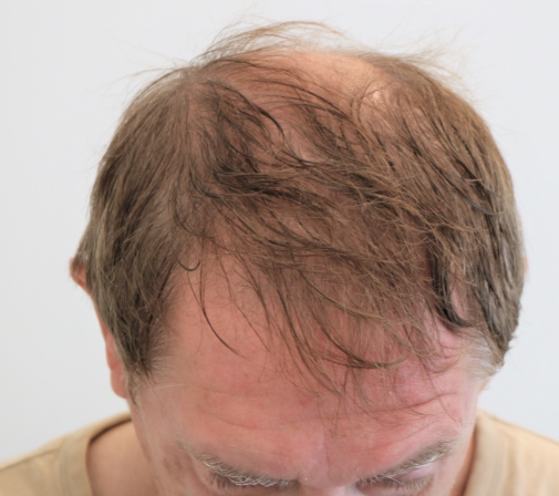 /foren/transplant/index.php/fa/46865/0/