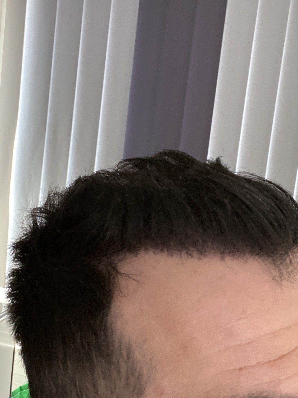 /foren/transplant/index.php/fa/46899/0/