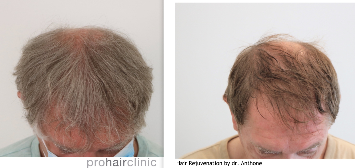 /foren/transplant/index.php/fa/46913/0/