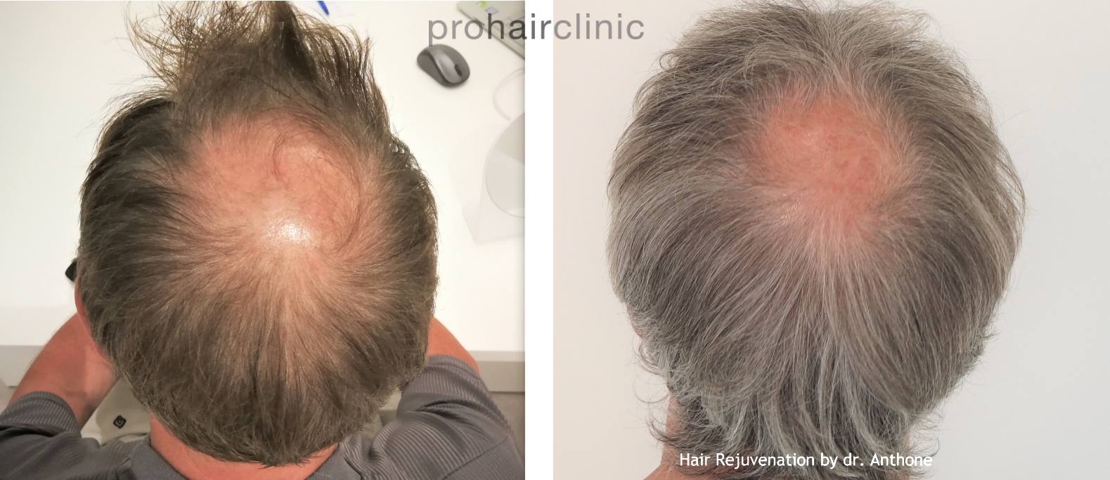 /foren/transplant/index.php/fa/46914/0/