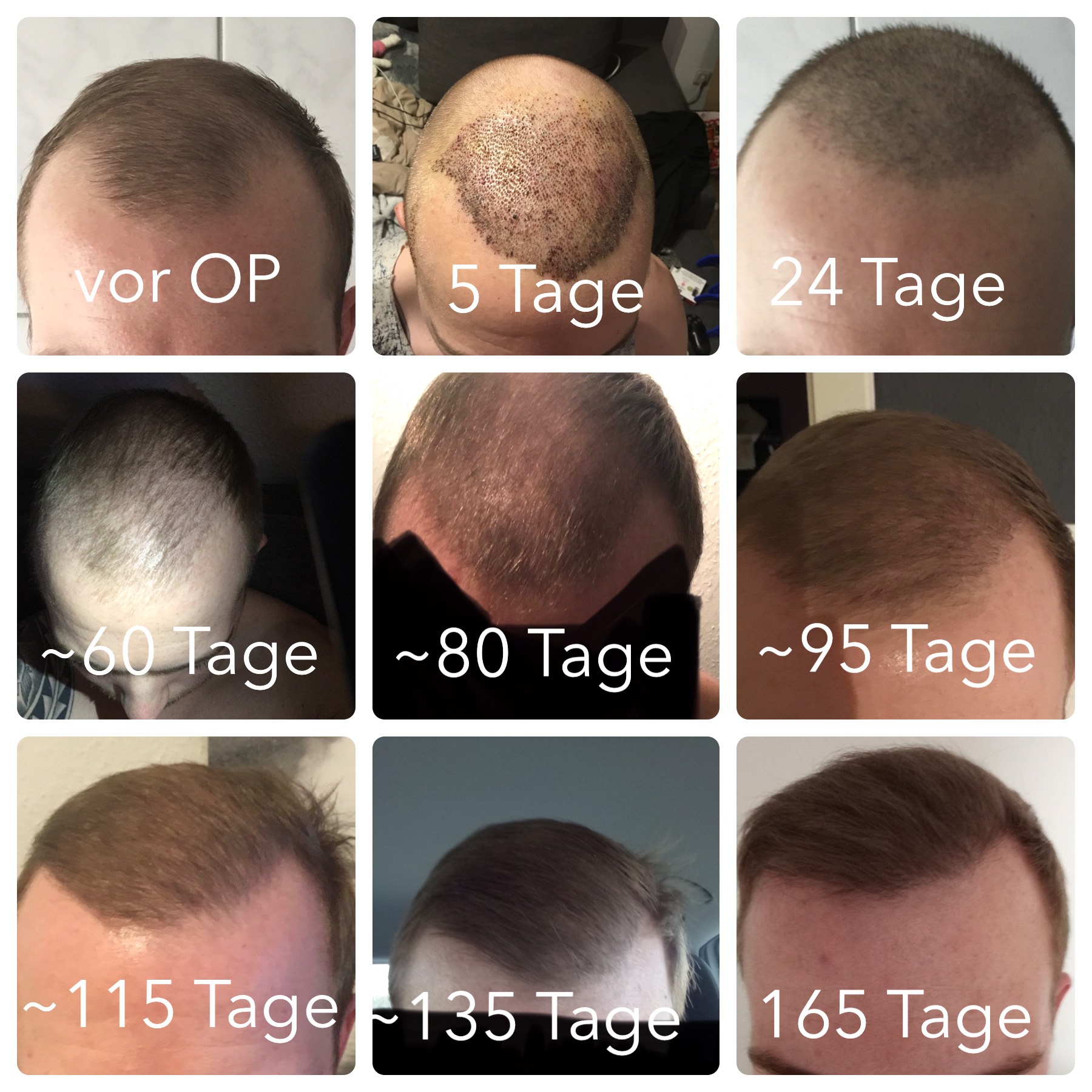 /foren/transplant/index.php/fa/46959/0/