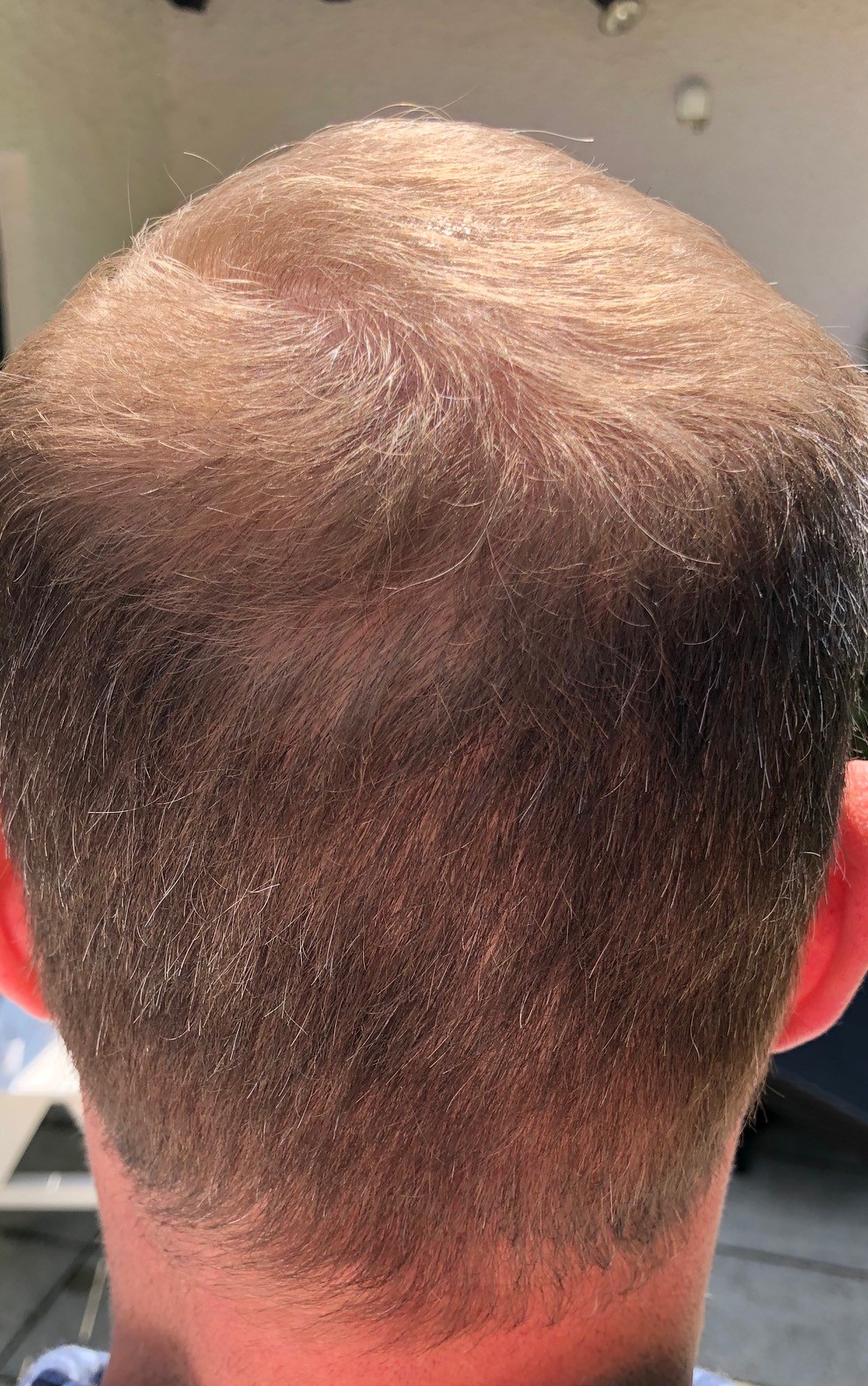 /foren/transplant/index.php/fa/46967/0/