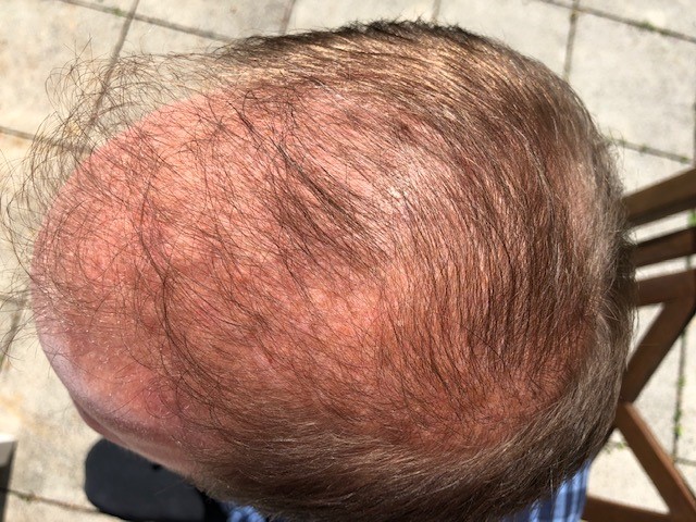 /foren/transplant/index.php/fa/46969/0/