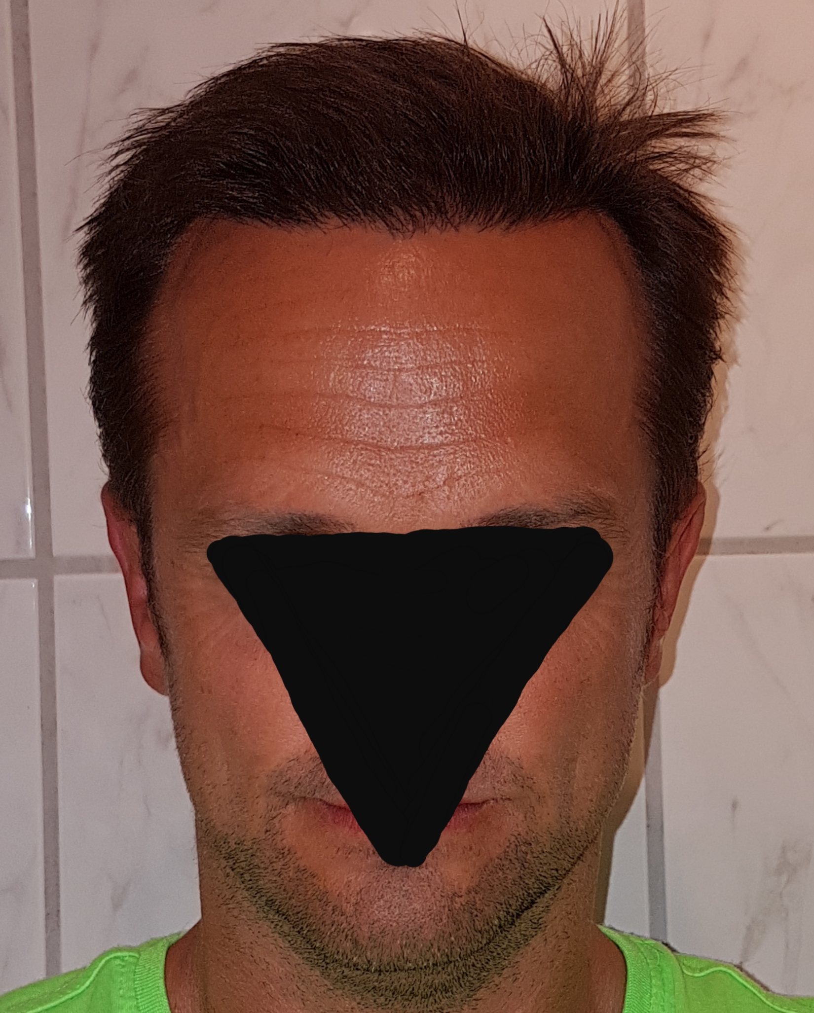 /foren/transplant/index.php/fa/47001/0/