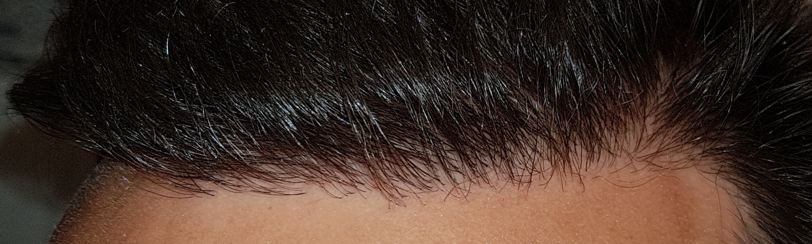 /foren/transplant/index.php/fa/47003/0/