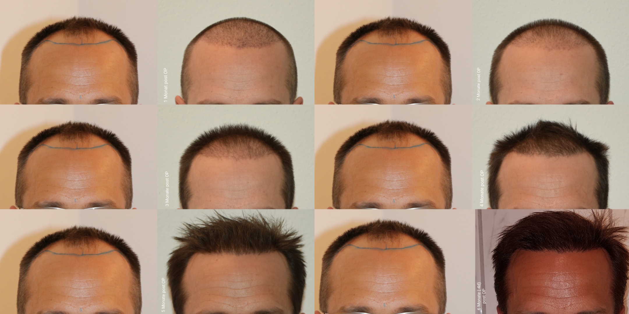 /foren/transplant/index.php/fa/47004/0/