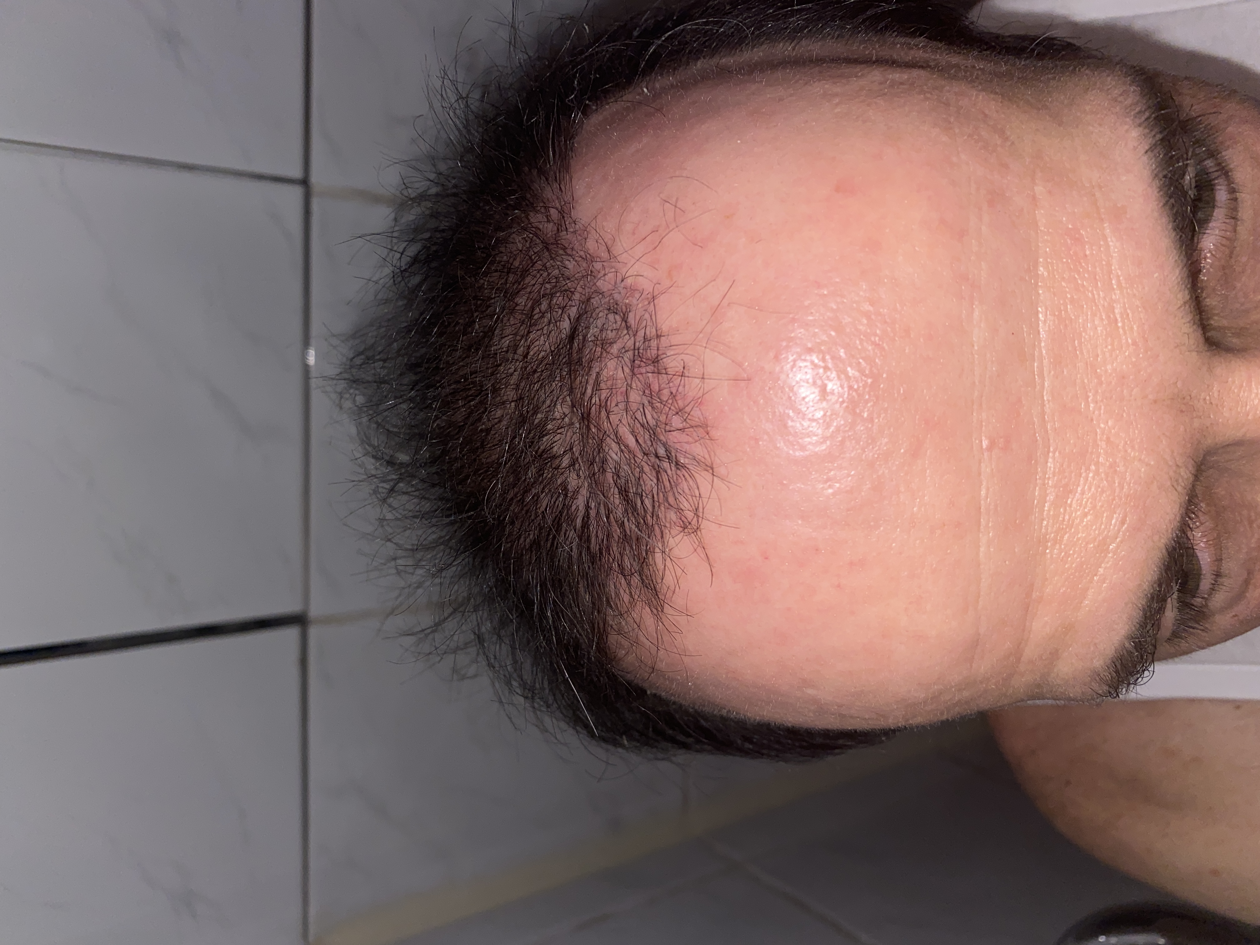 /foren/transplant/index.php/fa/47013/0/