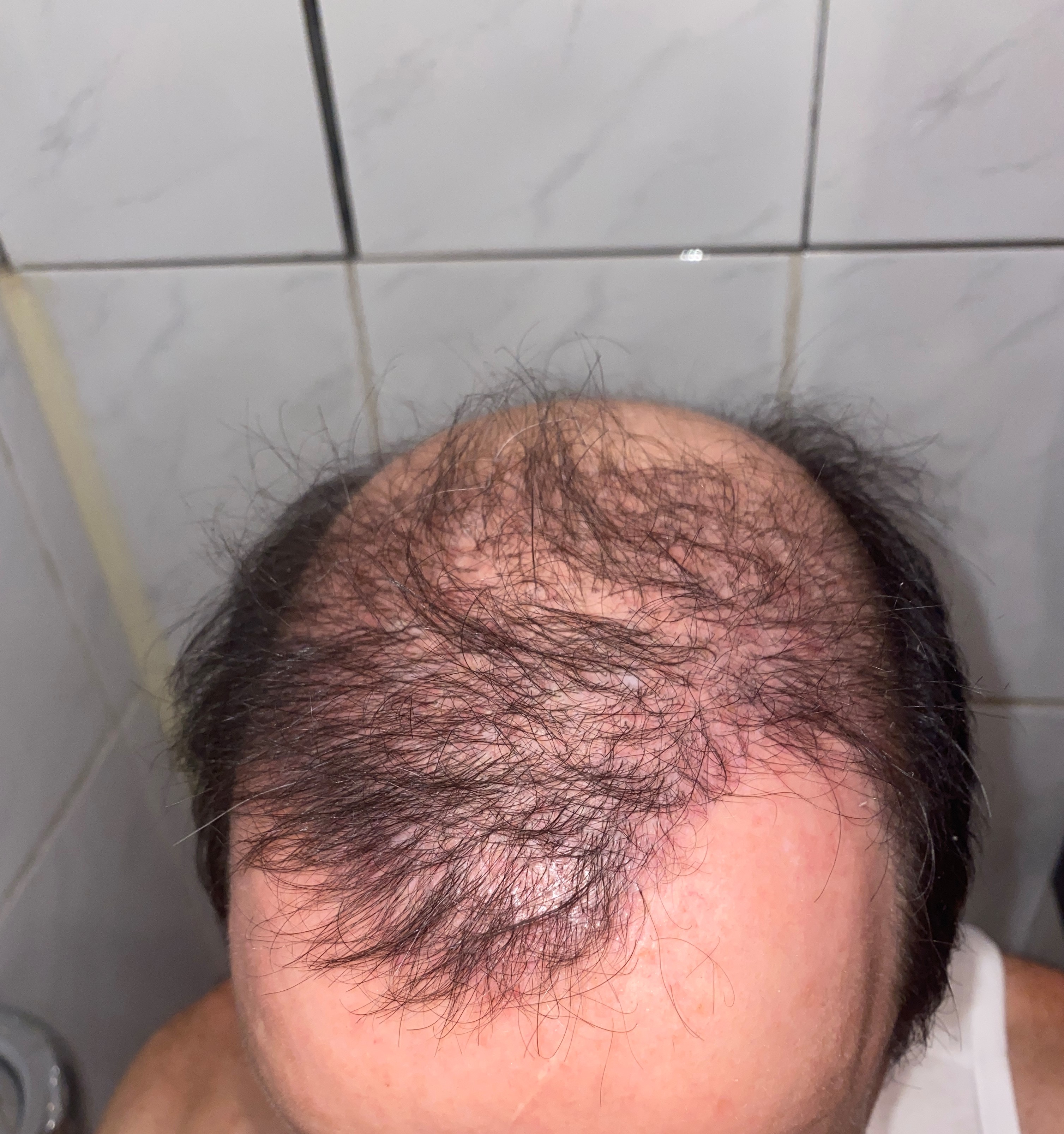 /foren/transplant/index.php/fa/47014/0/