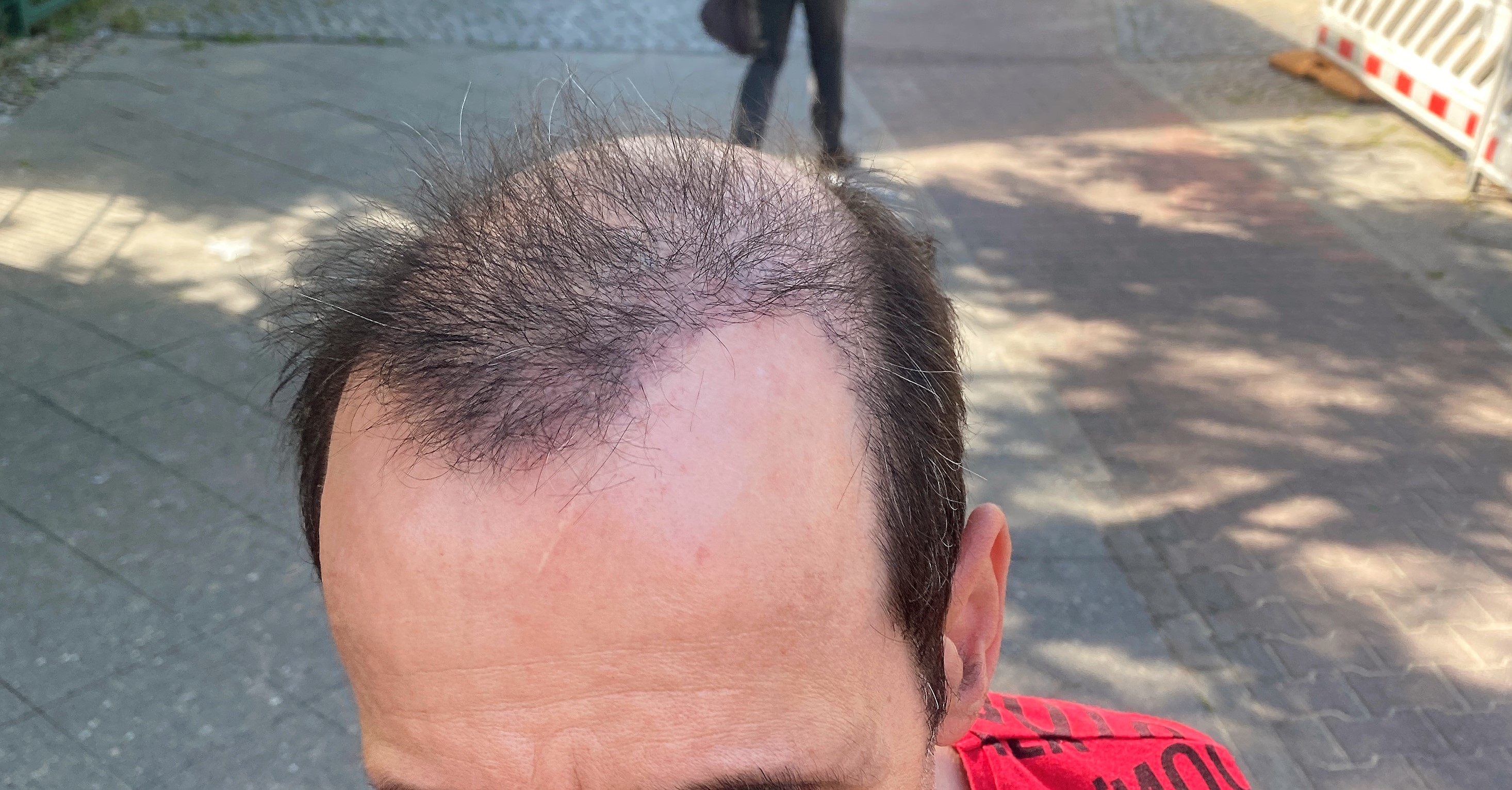 /foren/transplant/index.php/fa/47015/0/