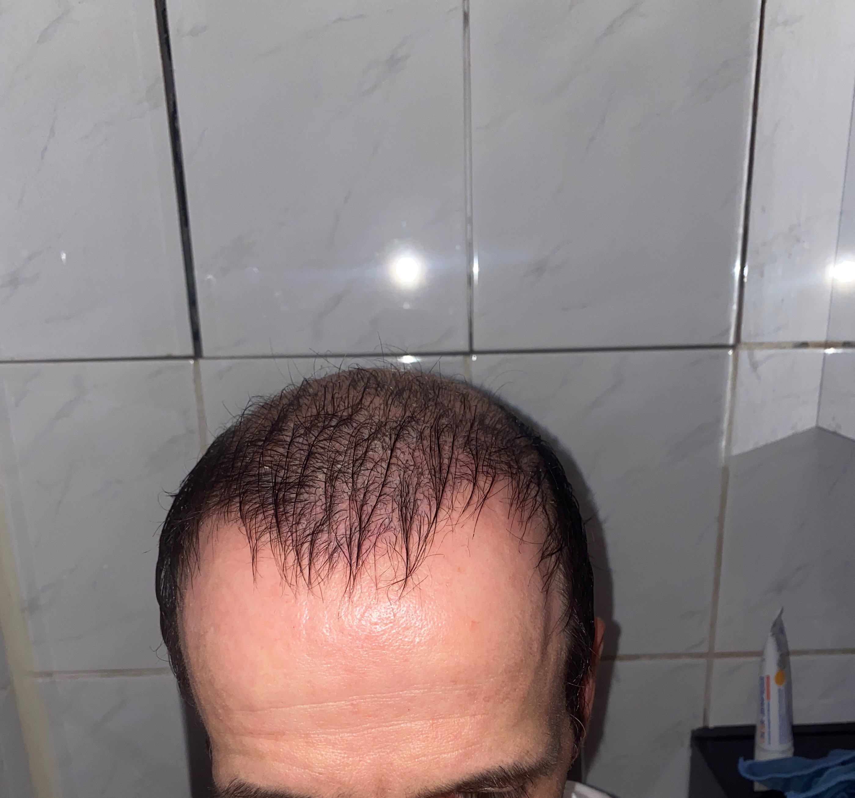 /foren/transplant/index.php/fa/47016/0/