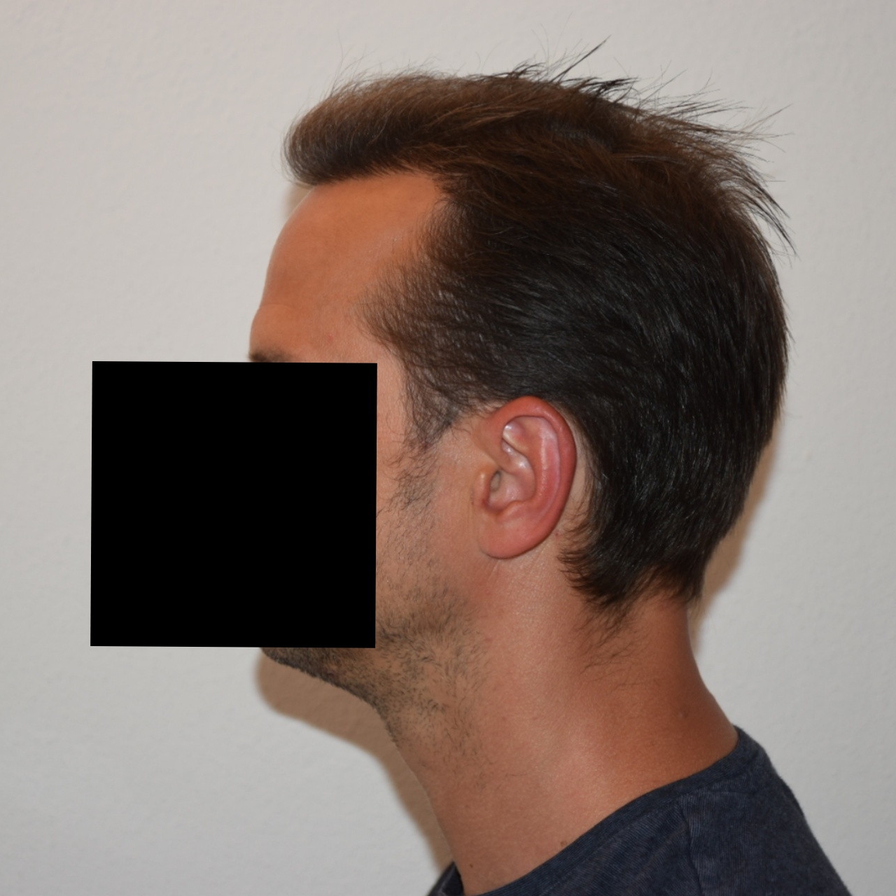 /foren/transplant/index.php/fa/47035/0/