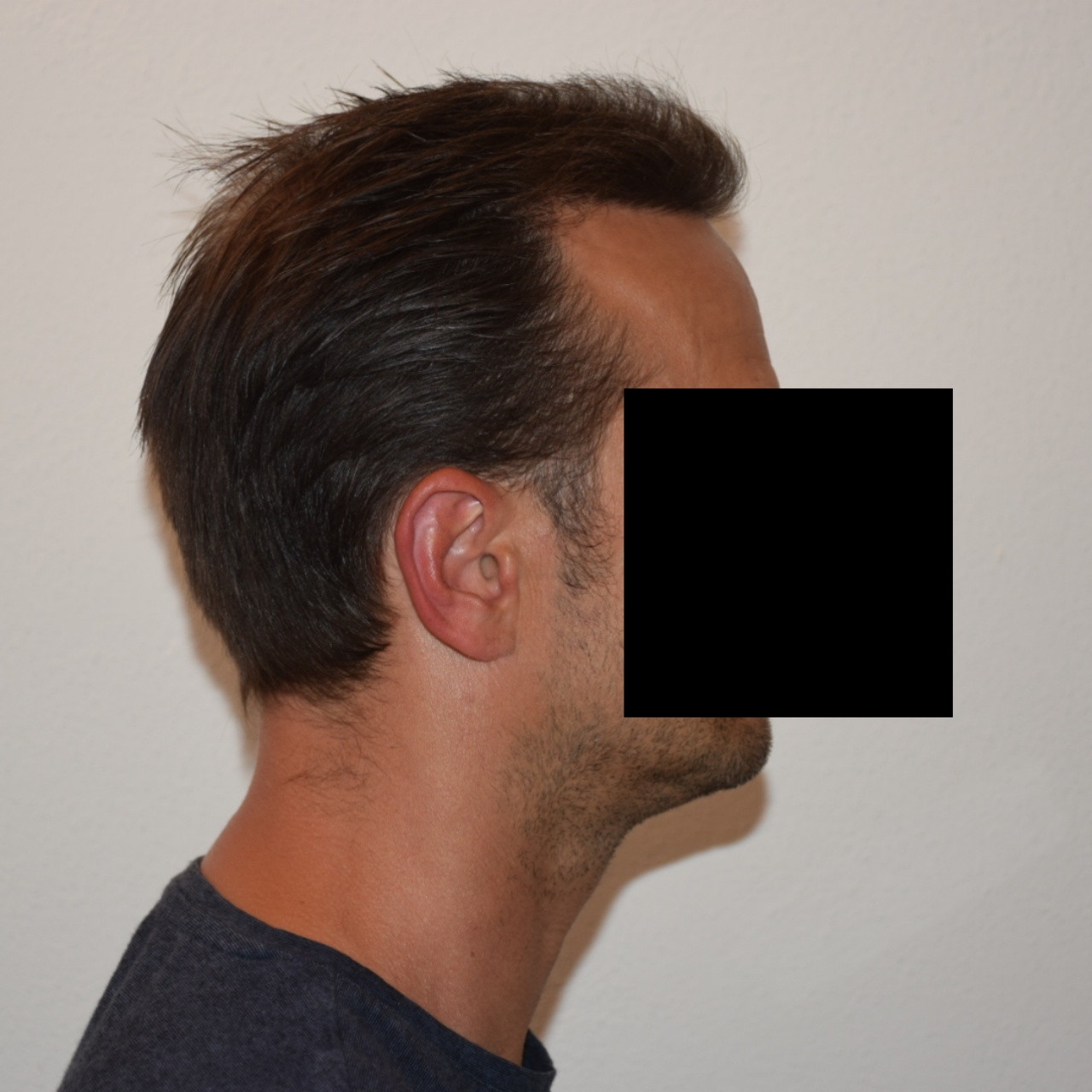 /foren/transplant/index.php/fa/47036/0/