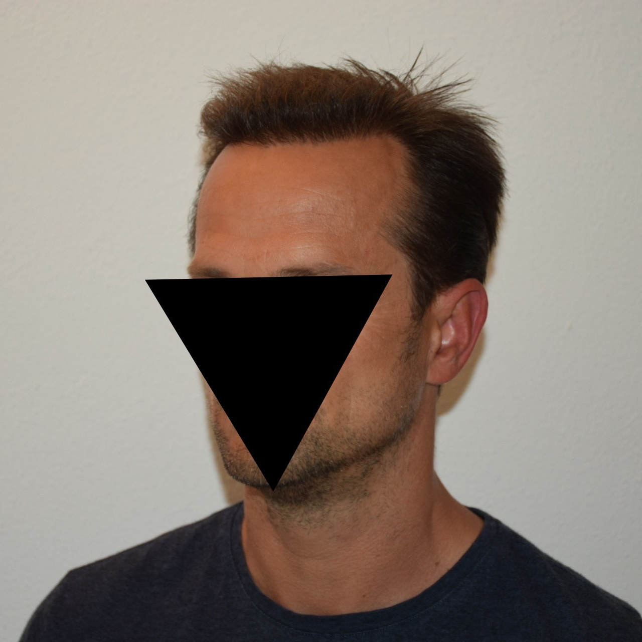 /foren/transplant/index.php/fa/47038/0/