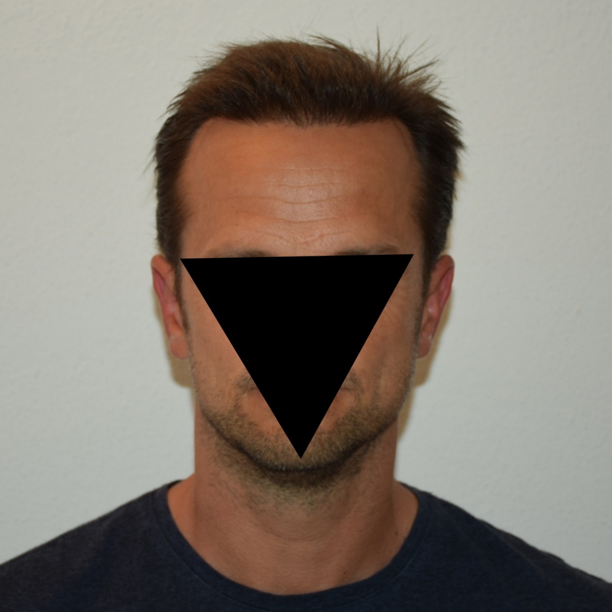 /foren/transplant/index.php/fa/47039/0/