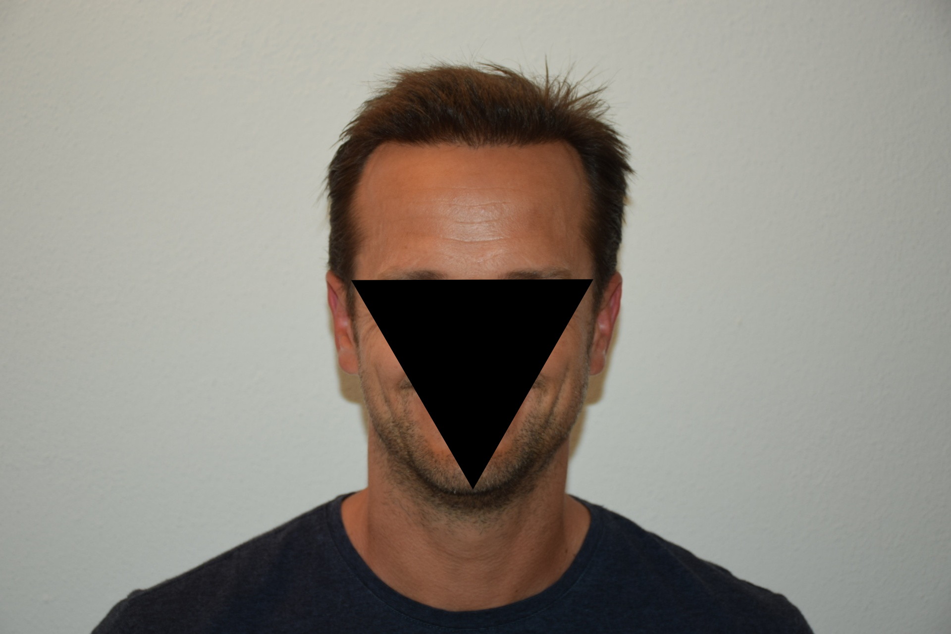 /foren/transplant/index.php/fa/47040/0/