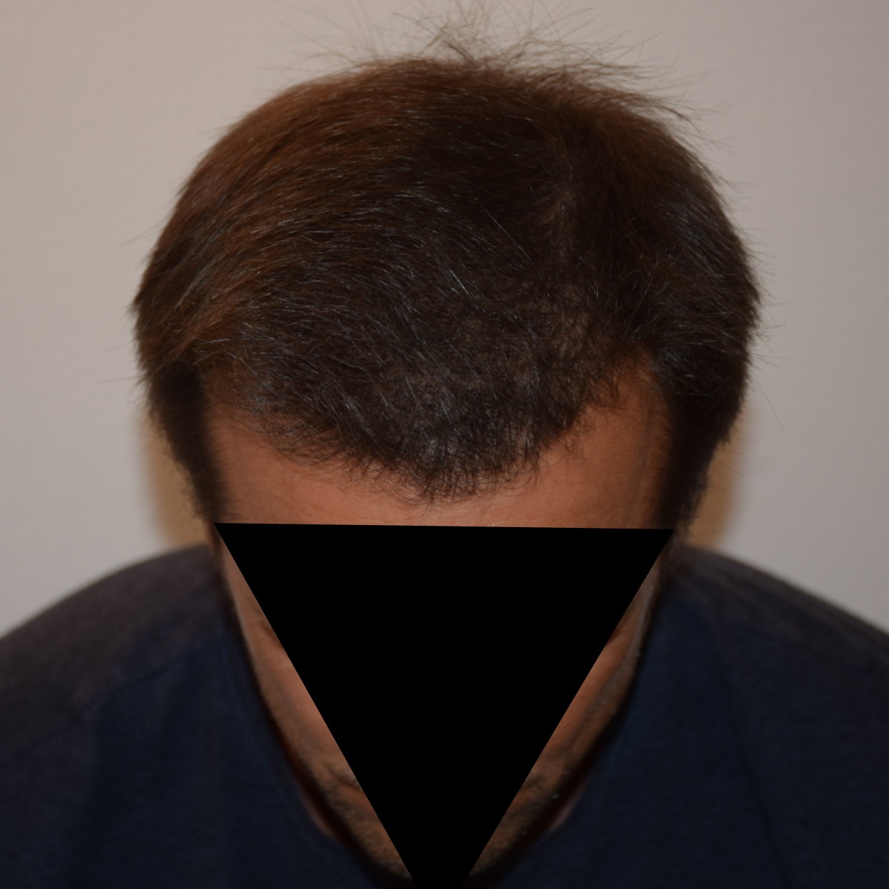 /foren/transplant/index.php/fa/47042/0/