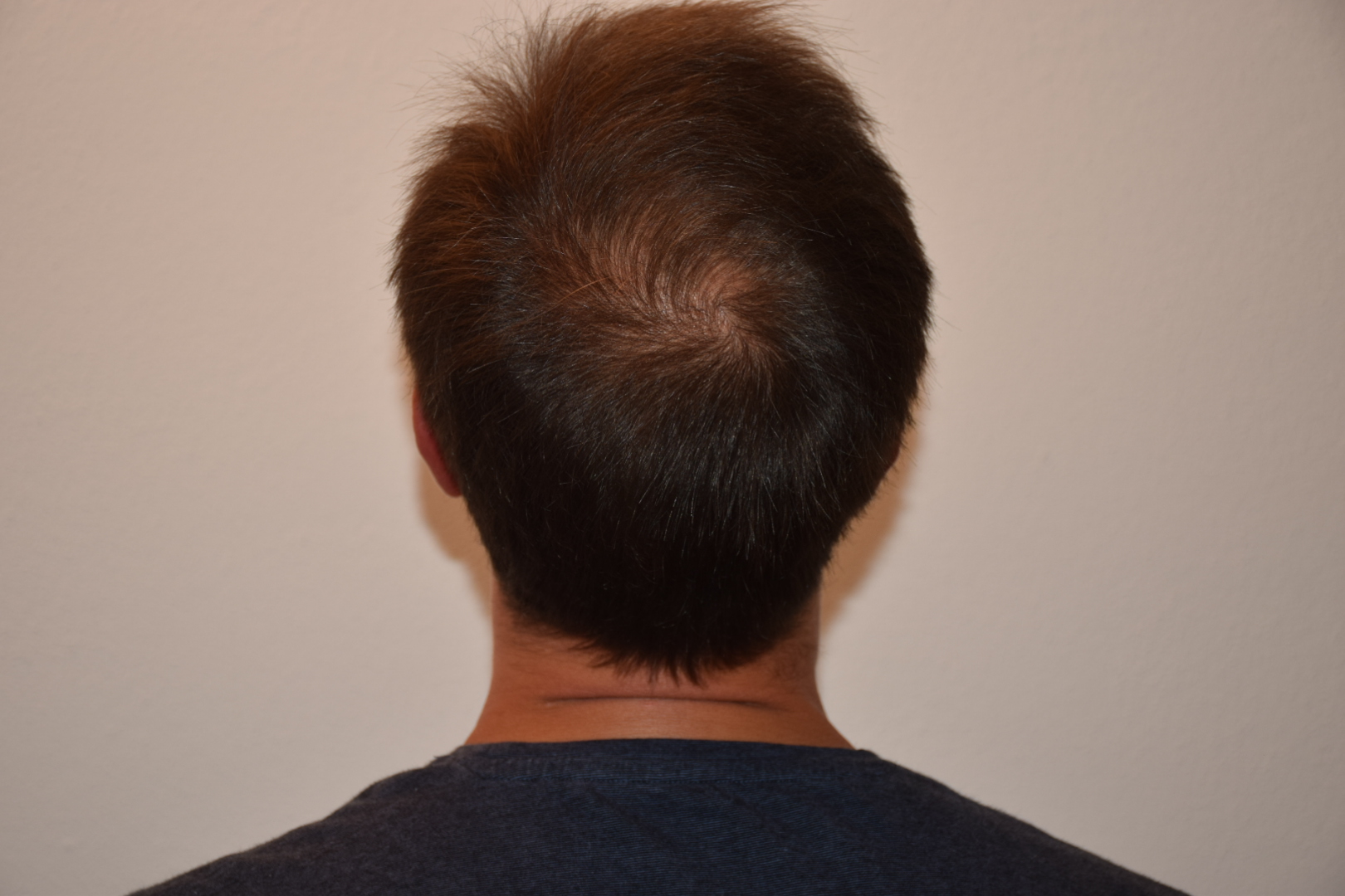 /foren/transplant/index.php/fa/47043/0/