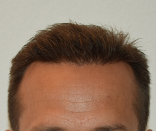 /foren/transplant/index.php/fa/47065/0/