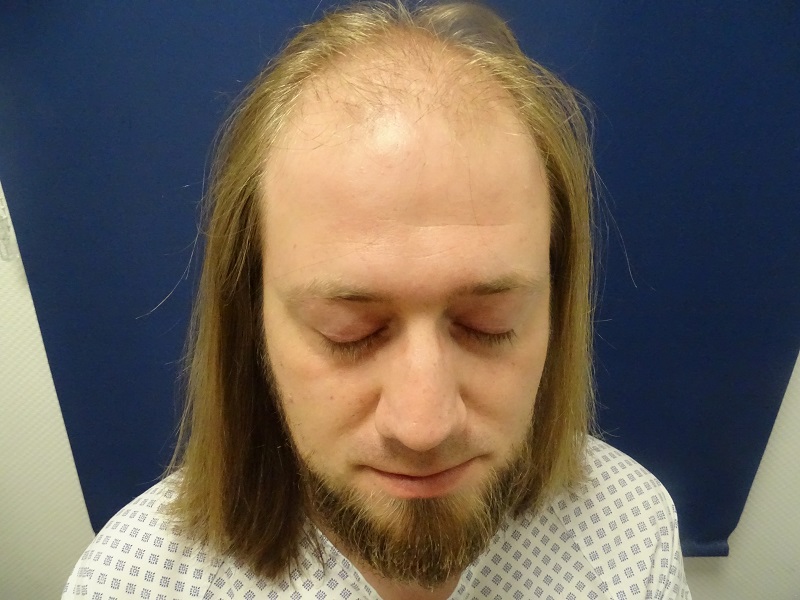 /foren/transplant/index.php/fa/47078/0/