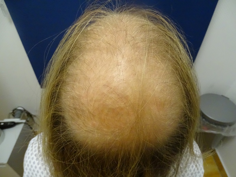 /foren/transplant/index.php/fa/47082/0/