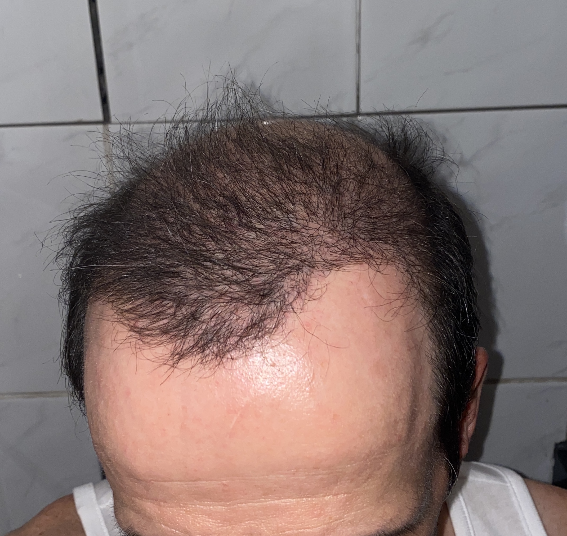 /foren/transplant/index.php/fa/47101/0/