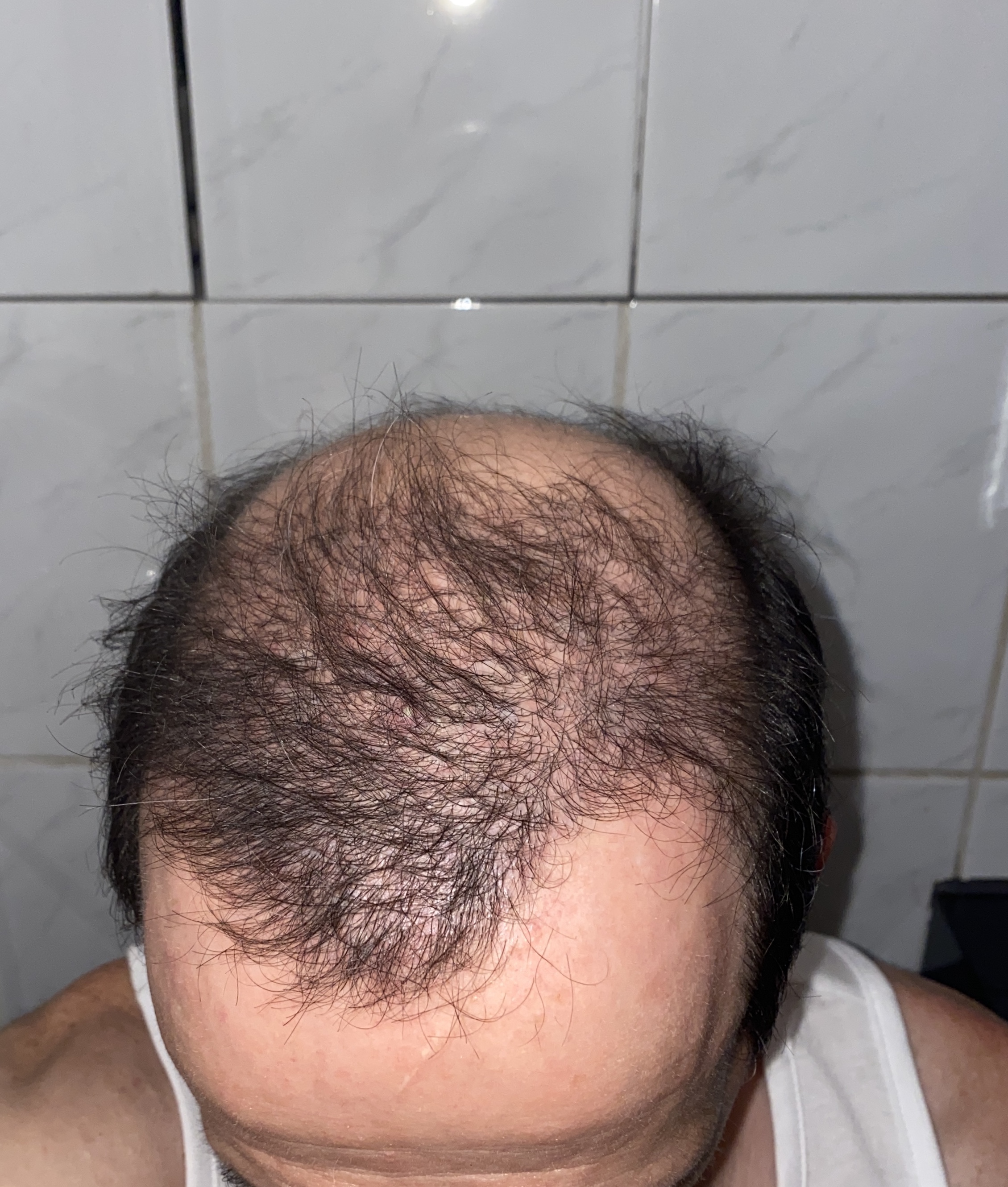 /foren/transplant/index.php/fa/47102/0/