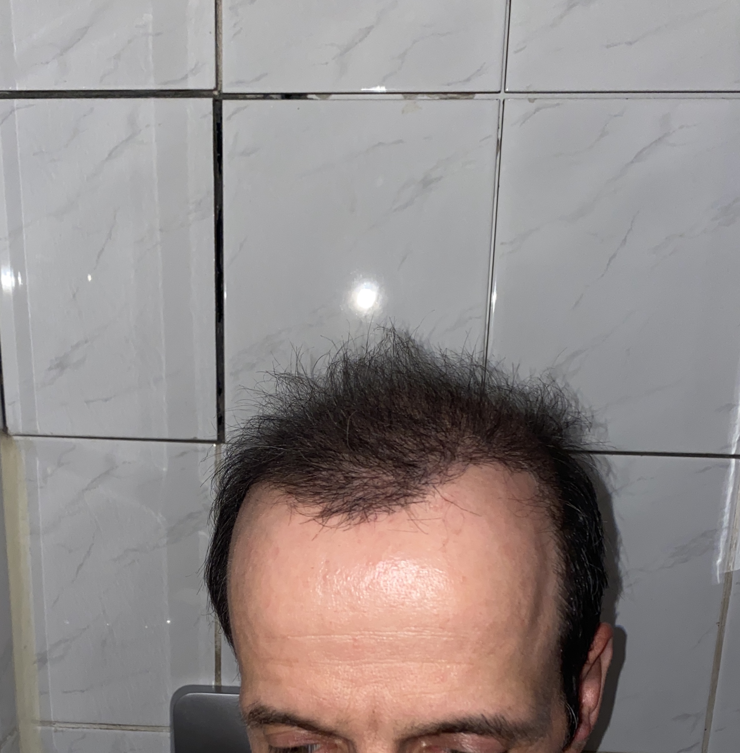 /foren/transplant/index.php/fa/47103/0/