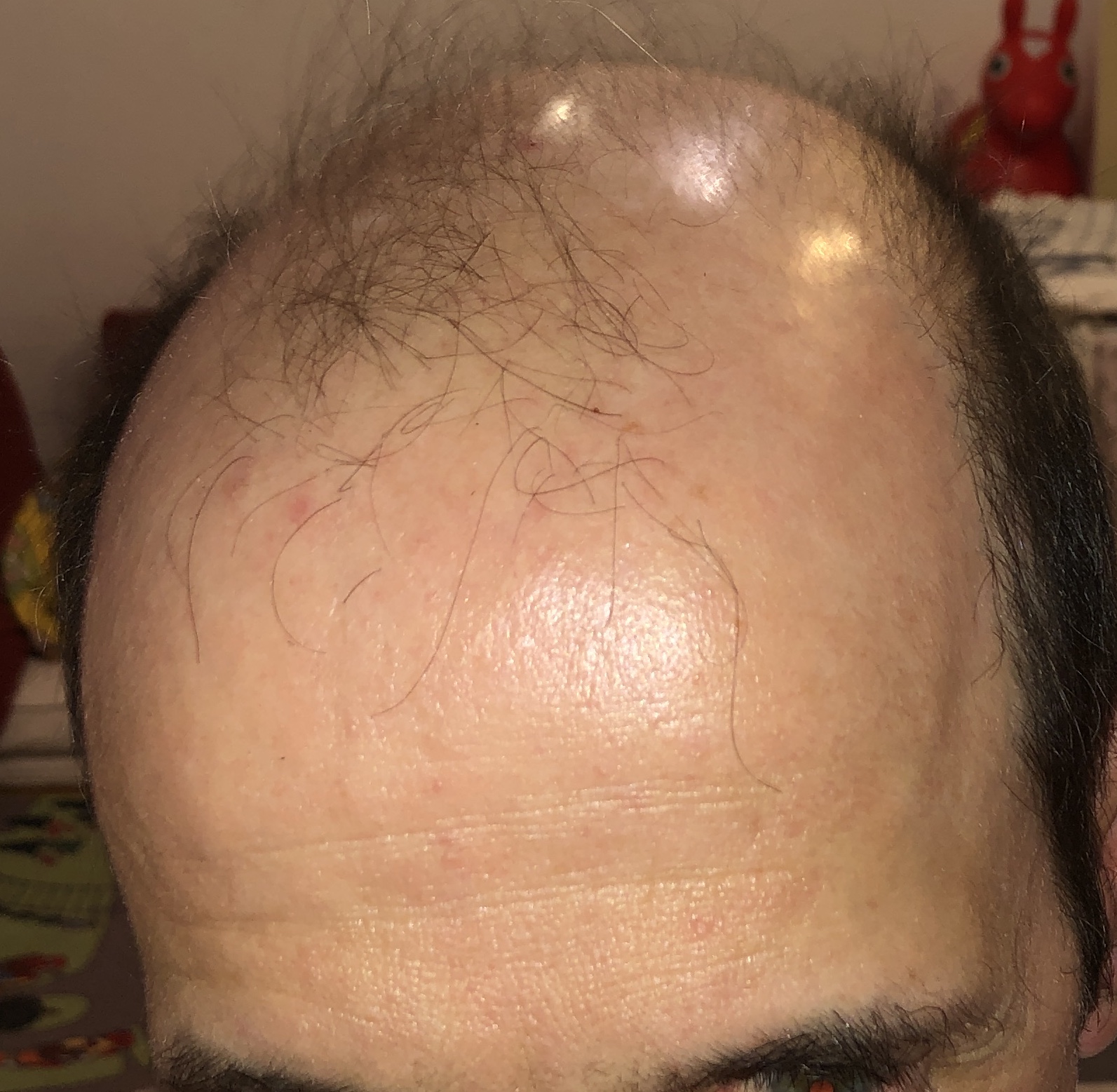 /foren/transplant/index.php/fa/47105/0/