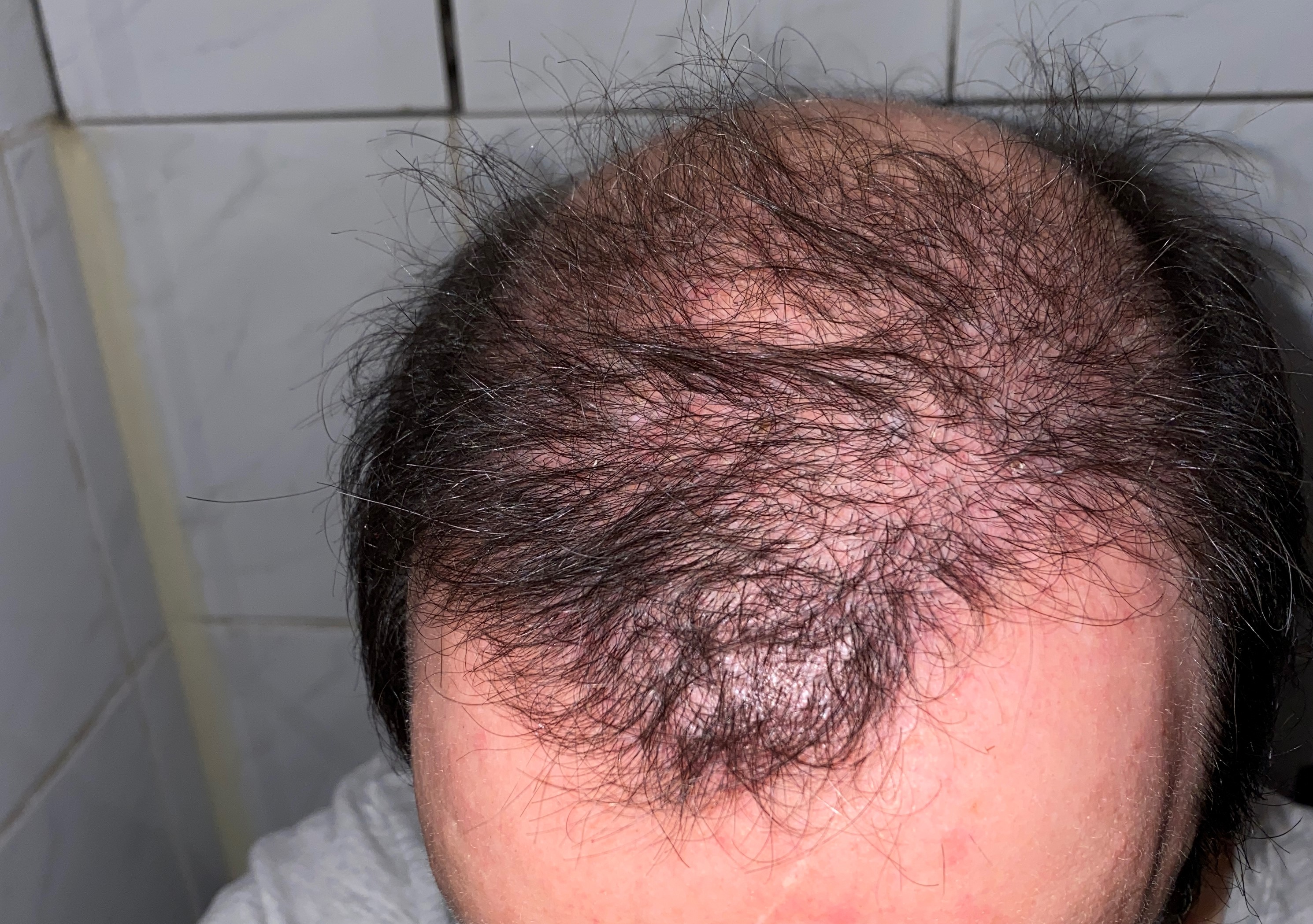 /foren/transplant/index.php/fa/47177/0/