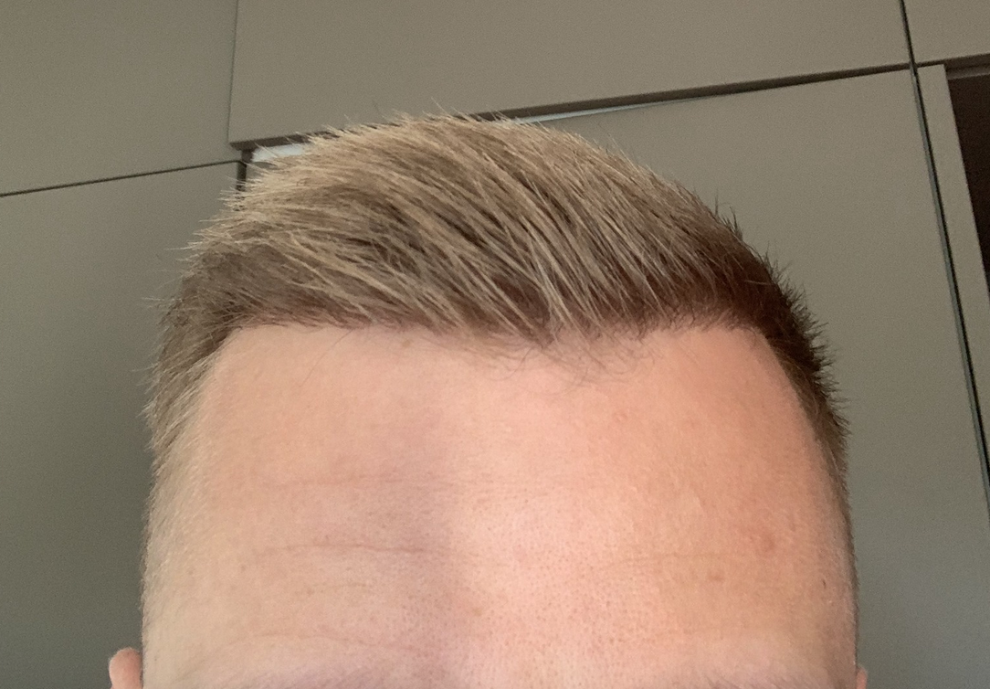 /foren/transplant/index.php/fa/47178/0/