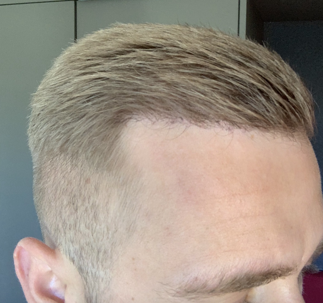 /foren/transplant/index.php/fa/47180/0/