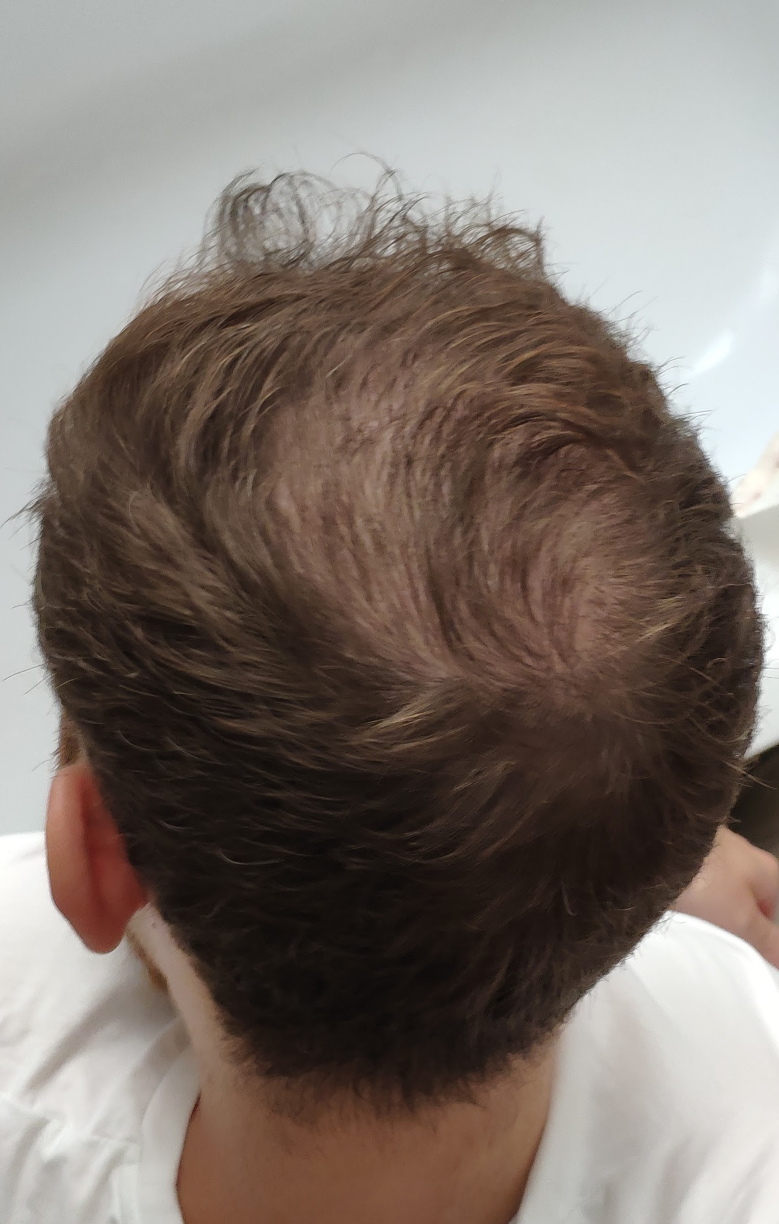 /foren/transplant/index.php/fa/47182/0/