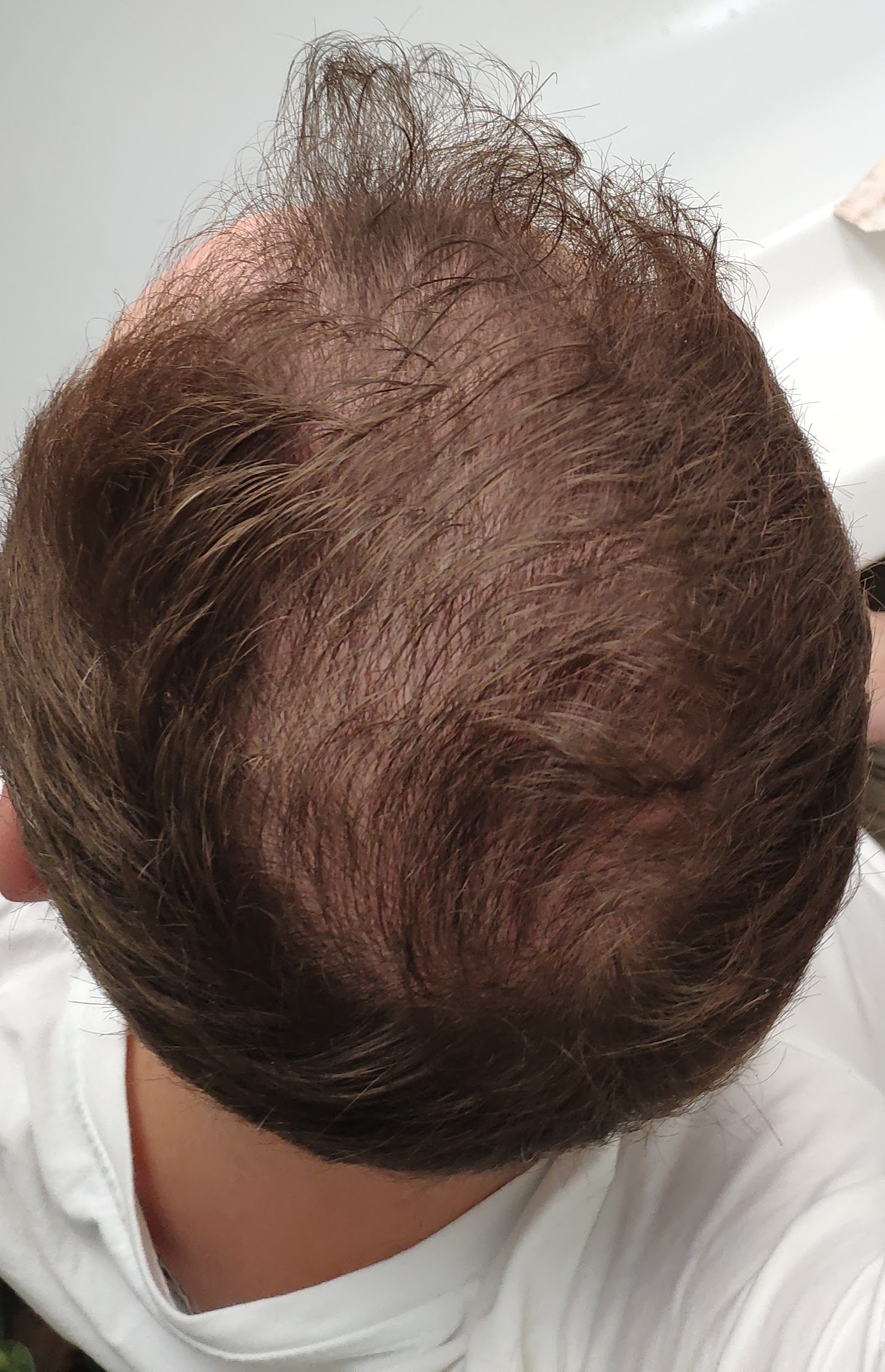 /foren/transplant/index.php/fa/47183/0/