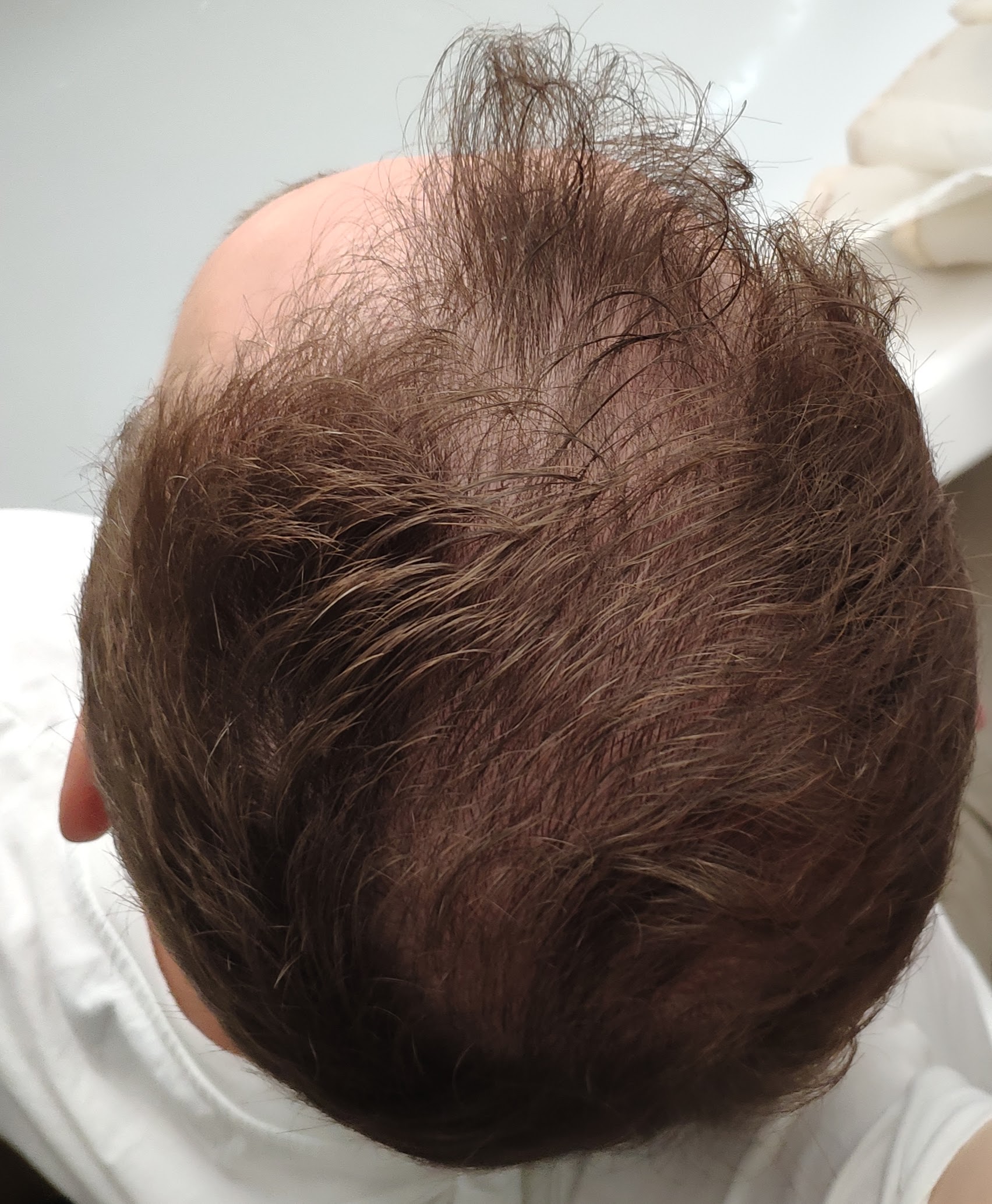 /foren/transplant/index.php/fa/47184/0/