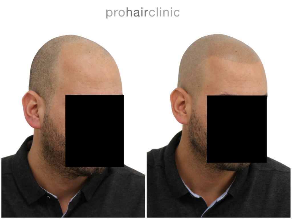 /foren/transplant/index.php/fa/47280/0/