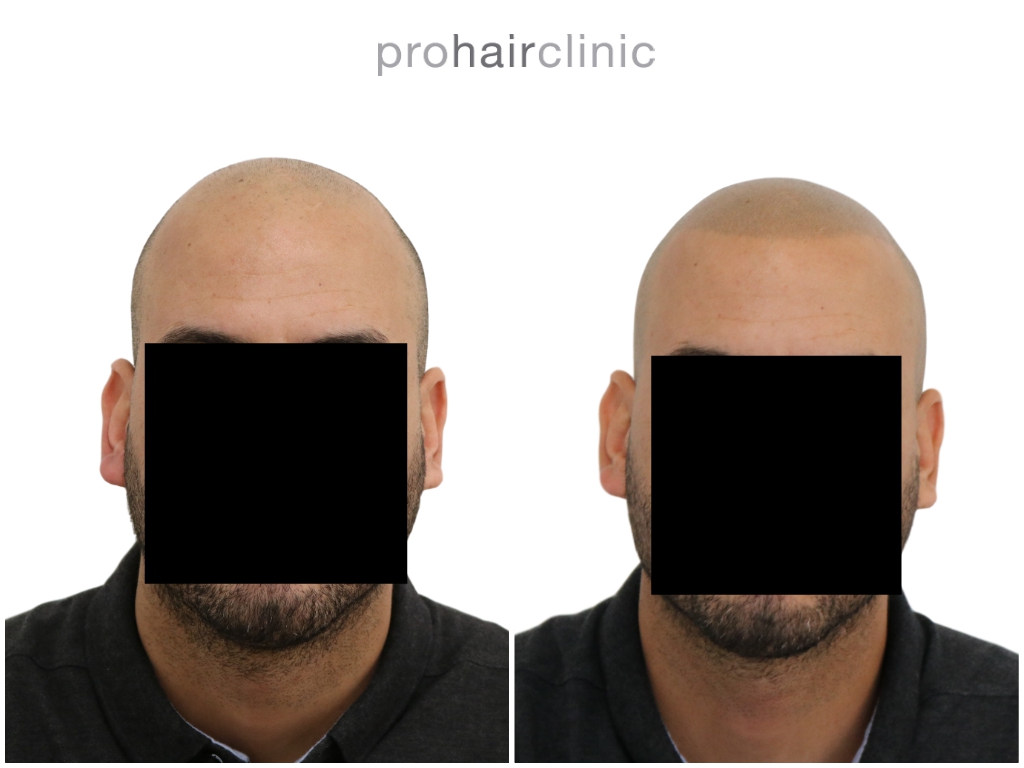 /foren/transplant/index.php/fa/47281/0/