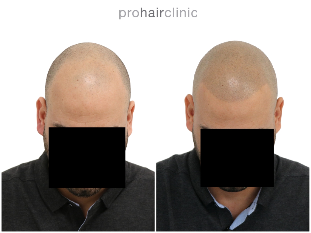 /foren/transplant/index.php/fa/47282/0/