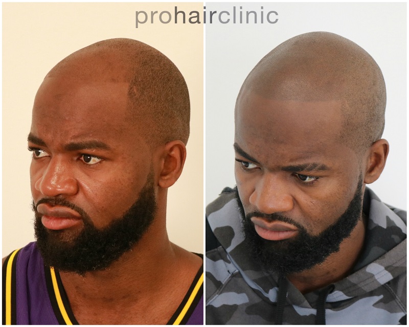 /foren/transplant/index.php/fa/47317/0/